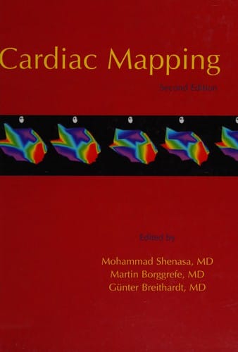 Cardiac mapping