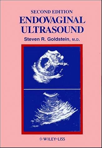 Endovaginal ultrasound