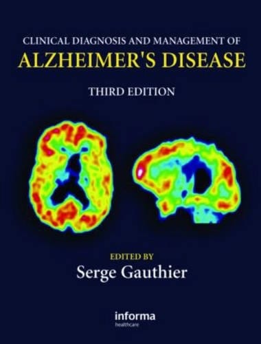 Clinical diagnosis and management of Alzheimer's disease