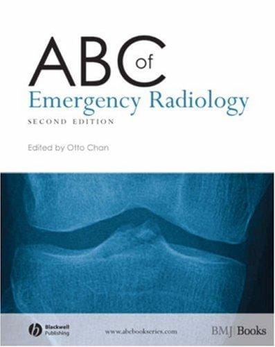 ABC of emergency radiology
