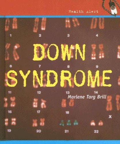 Down Syndrome (Health Aleart)