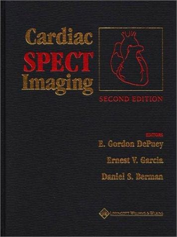 Cardiac spect imaging