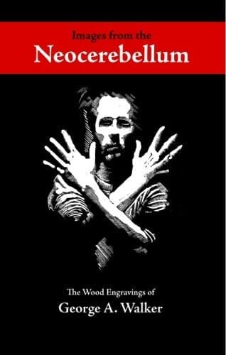 Images from the neocerebellum