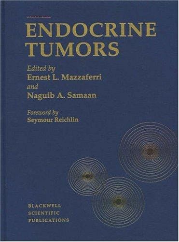 Endocrine tumors