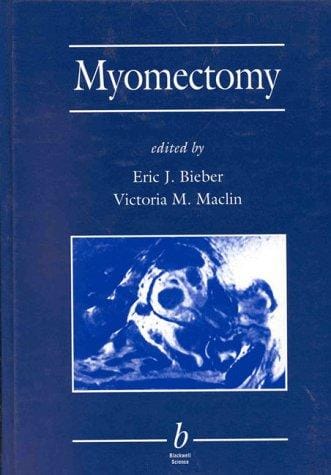 Myomectomy