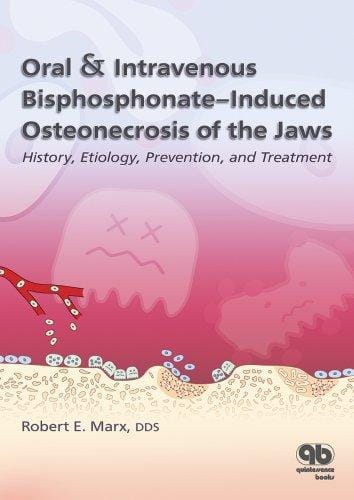 Oral & intravenous bisphosphonate-induced osteonecrosis of the jaws