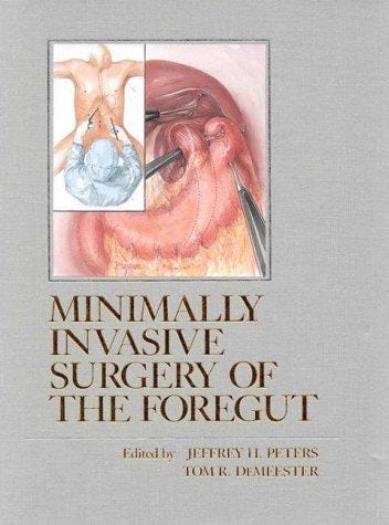Minimally invasive surgery of the foregut