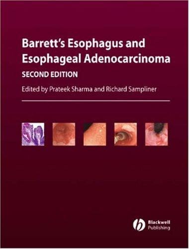Barrett's esophagus and esophageal adenocarcinoma