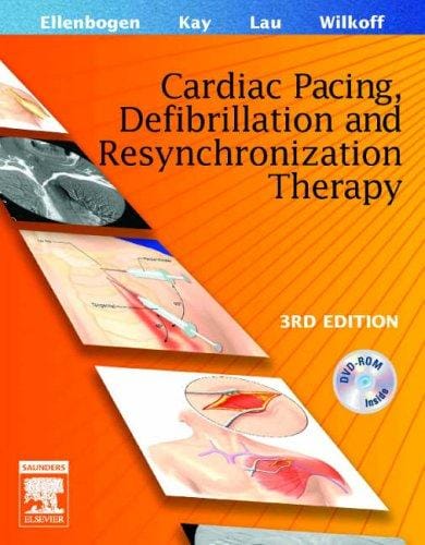 Clinical cardiac pacing and defibrillation therapy