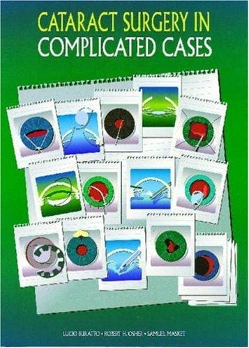 Cataract surgery in complicated cases