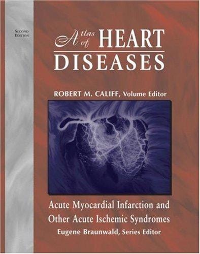 Acute myocardial infarction and other acute ischemic syndromes