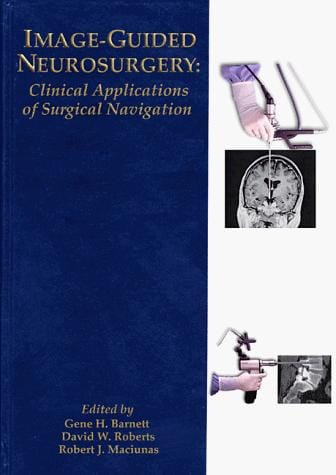 Image-guided neurosurgery