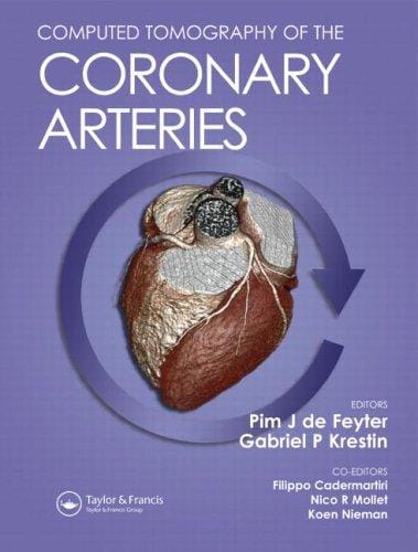 COMPUTED TOMOGRAPHY OF THE CORONARY ARTERIES