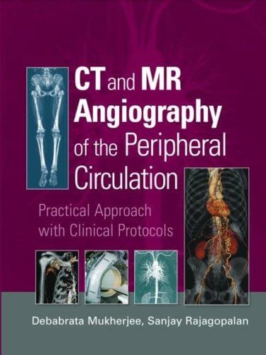 CT and MR angiography of the peripheral circulation