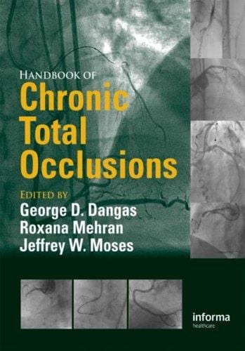 Handbook of chronic total occlusions