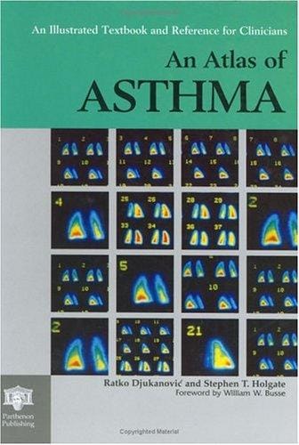 An atlas of asthma