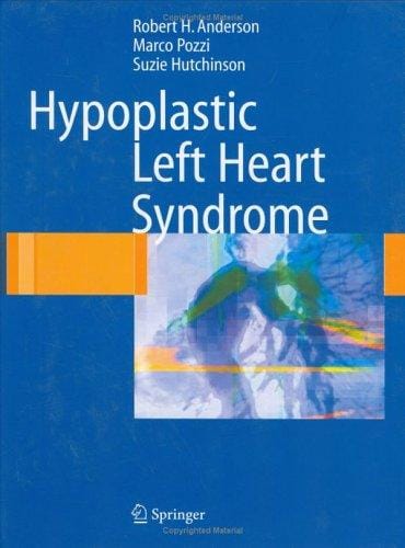 Hypoplastic left heart syndrome