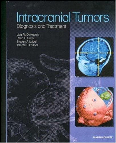 Intracranial tumors