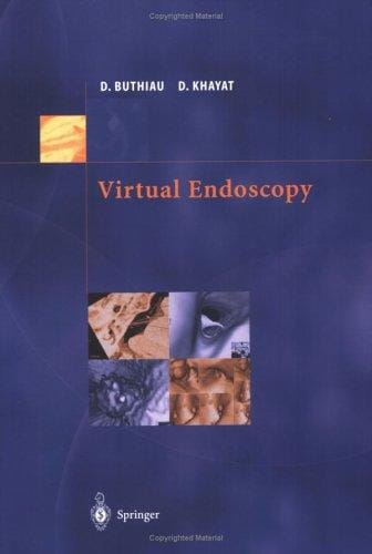 Virtual endoscopy