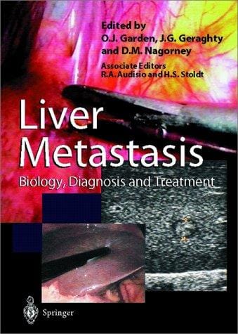 Liver metastases