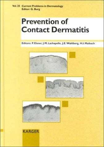 Prevention of contact dermatitis