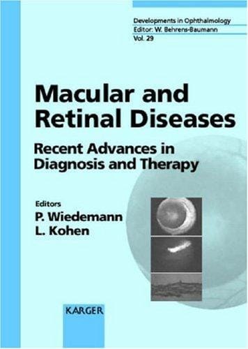 Macular and retinal diseases