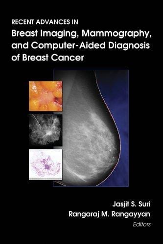 Recent advances in breast imaging, mammography, and computer-aided diagnosis of breast cancer