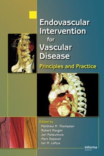 Endovascular intervention for vascular disease