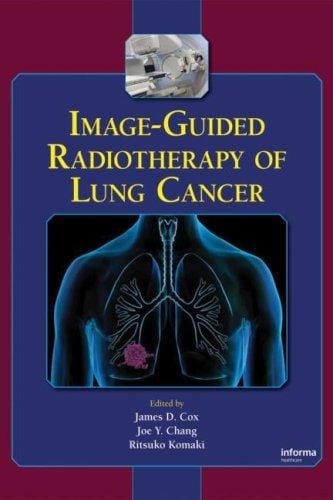 Image-guided radiotherapy of lung cancer