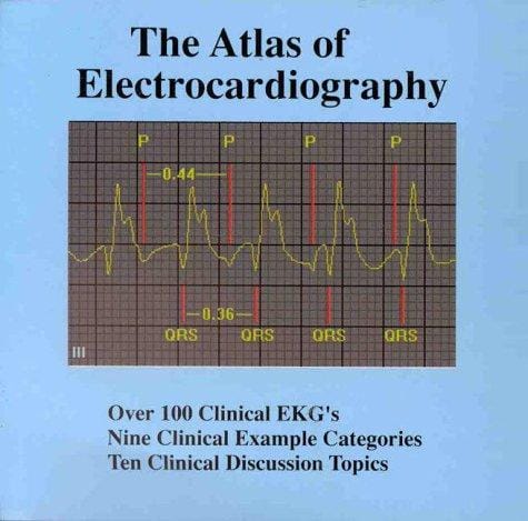 The Atlas of Electrocardiography for Windows, Student Version