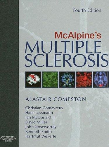 McAlpine's multiple sclerosis