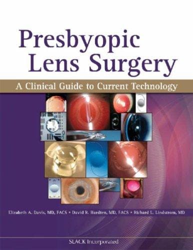 Presbyopic lens surgery