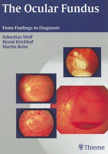 The ocular fundus