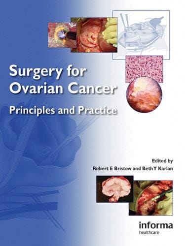 Surgery for ovarian cancer