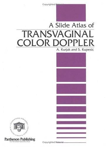 A Slide Atlas of Transvaginal Color Doppler