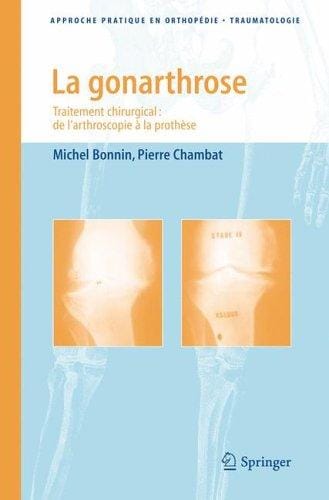 La gonarthrose: Traitement chirurgical
