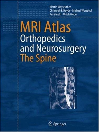 MRI atlas