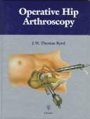 Operative hip arthroscopy