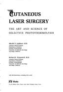 Cutaneous laser surgery
