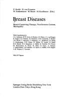 Breast diseases
