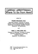 Cardiac arrhythmias