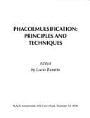 Phacoemulsification