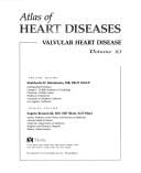 Valvular heart disease