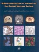WHO classification of tumours of the central nervous system