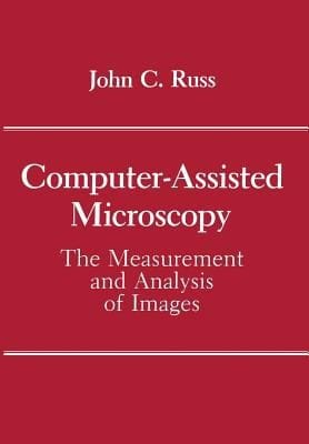 Computerassisted Microscopy The Measurement And Analysis Of Images