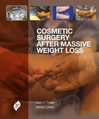 Cosmetic Surgery After Massive Weight Loss