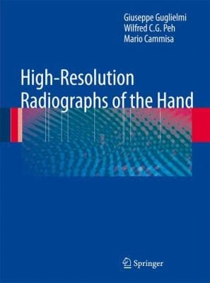 HighResolution Radiographs of the Hand