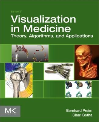 Visual Computing For Medicine Theory Algorithms And Applications