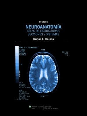 Neuroanatoma Atlas De Estructuras Secciones Y Sistemas