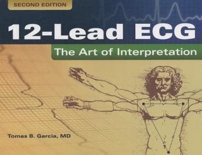 12lead Ecg The Art Of Interpretation